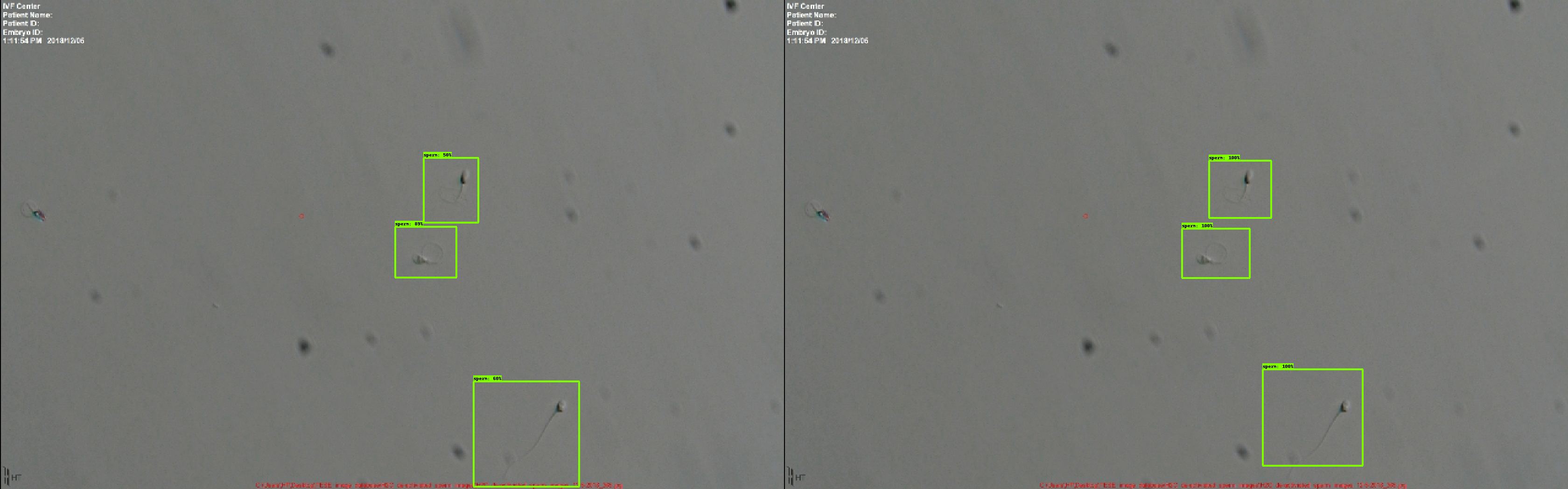 Example Sperm Detection